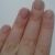 Продольная полоса на ногте большого пальца
