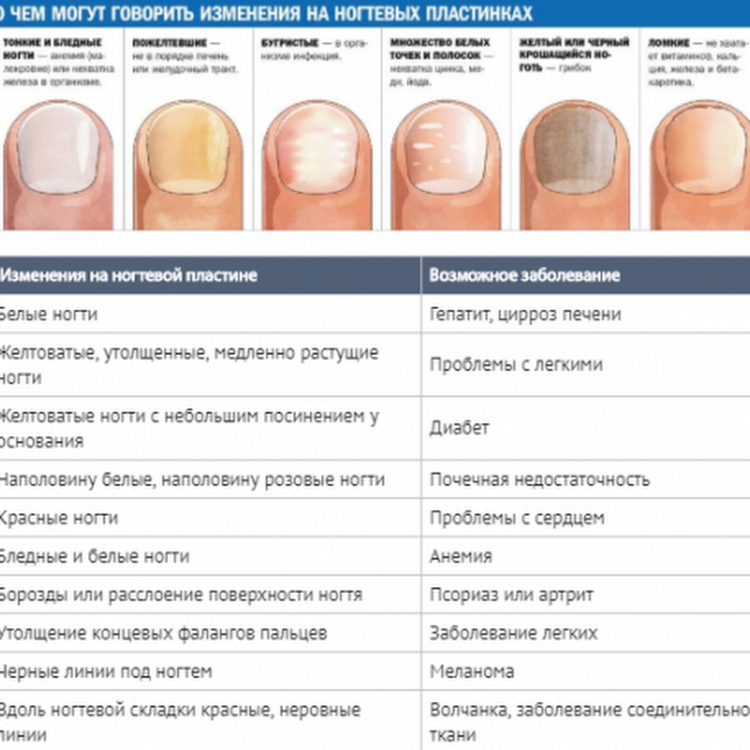 Ребристые ногти