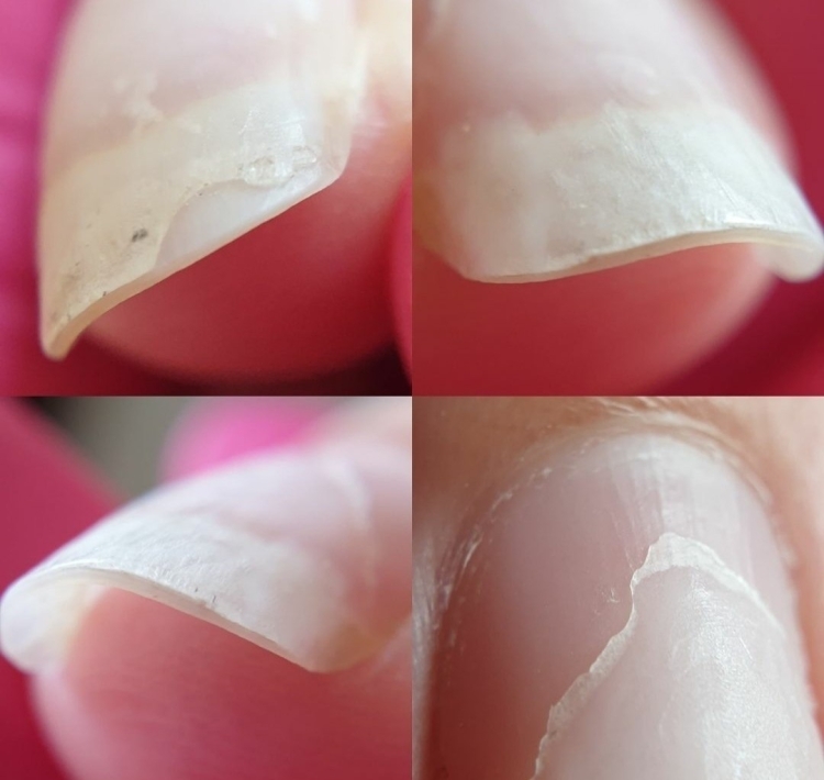 Почему гель быстро отслаивается от ногтя